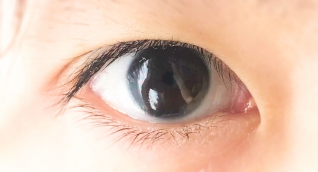眼瞼下垂の病名の認知度は17.7% さらに眼瞼下垂保険適用手術の認知度が低いことが判明