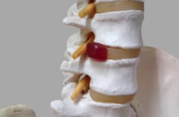 椎間板ヘルニア・脊柱管狭窄症　手術をしても治らなかったらやるべきこと【川口陽海の腰痛改善教室 第20回】